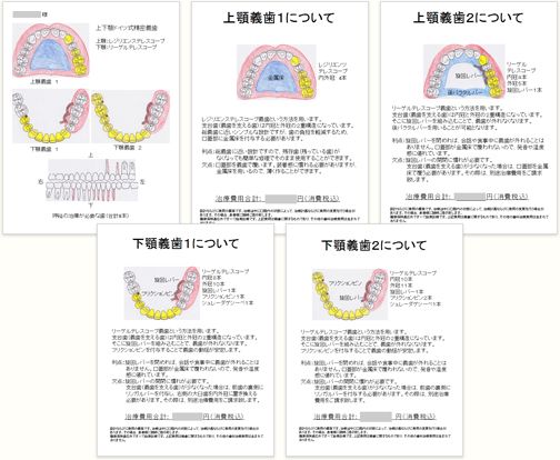 プレゼンテーション