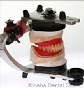 歯科技工士によるラボワーク